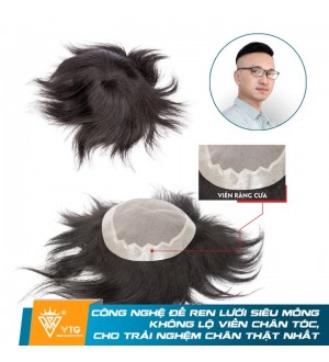 Tóc Giả Dạng Dán Che  Hói Nam Mái Simple Hair - VTG D11